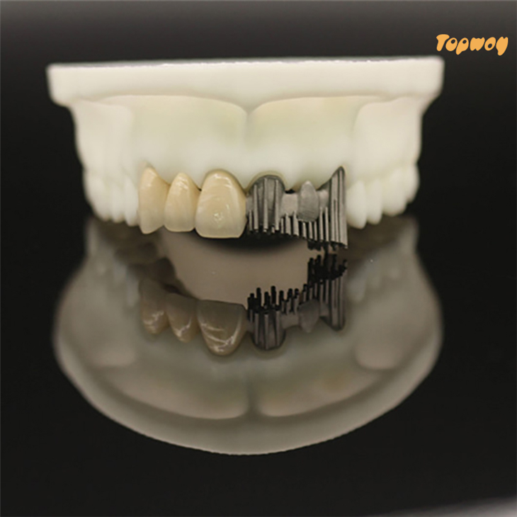 Dental Lab PFM Crowns and Bridge
