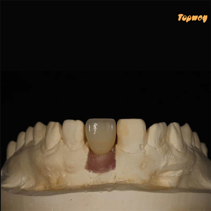Dental Implant Zirconia Dental Implant Zirconia